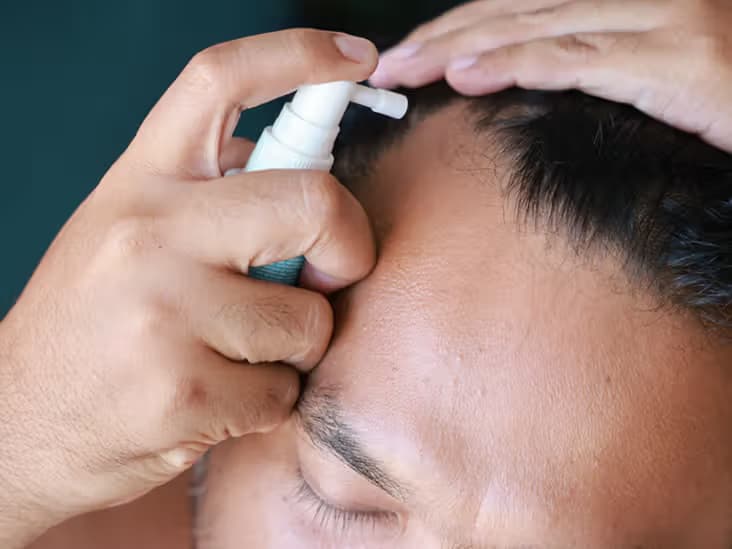 Saw Palmetto for Hair Loss: Myth or Miracle?