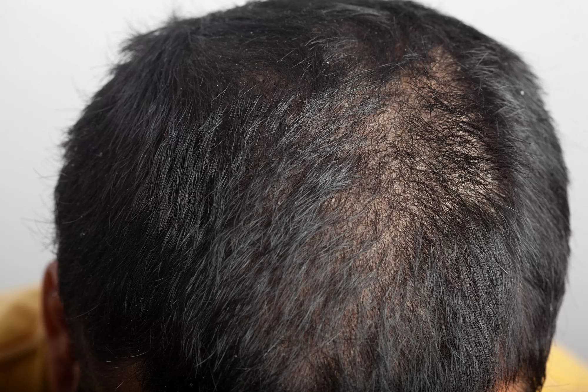 10 Natural Hair Treatment Tips for Hair Growth