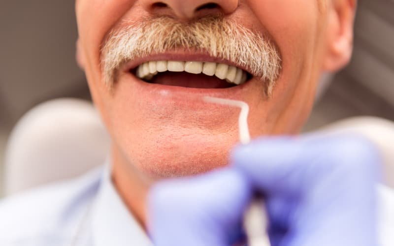 Dental Grant Programs in 2026: A Practical Guide to Financial Help for Dental Work