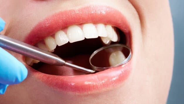 5 Easy Tips to Keep Your Teeth Clean and Sparkling