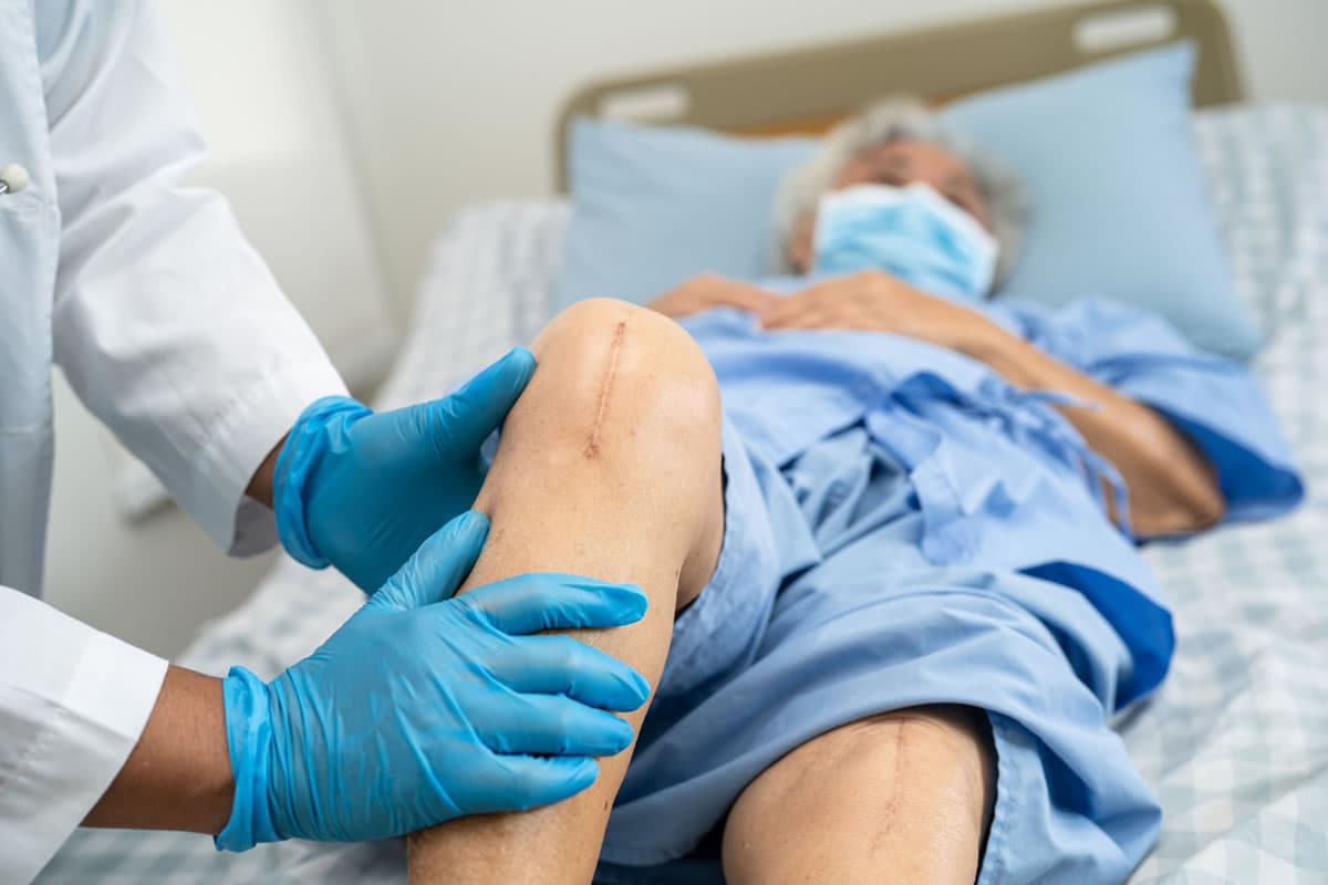 Knee Replacement Recovery Tips for Seniors: A Practical Guide