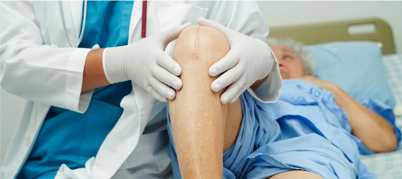 Top 10 Knee Replacement Surgeons in the USA: A Patient Reference Guide