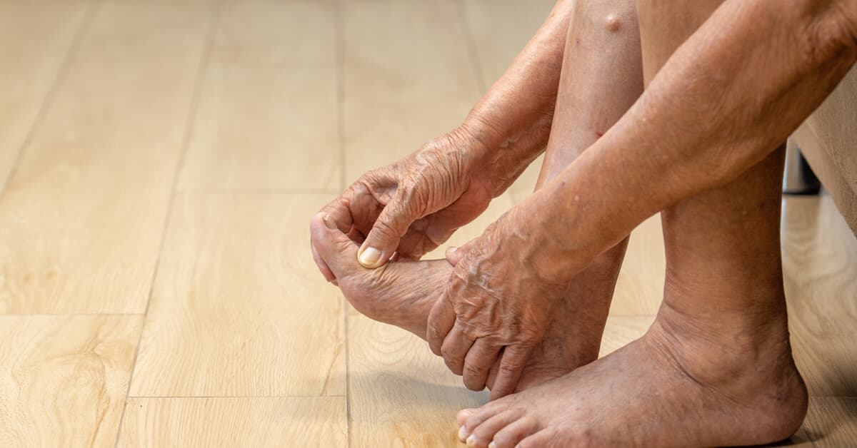Leg Swelling in Older Adults: Causes, Symptoms, and Care Tips